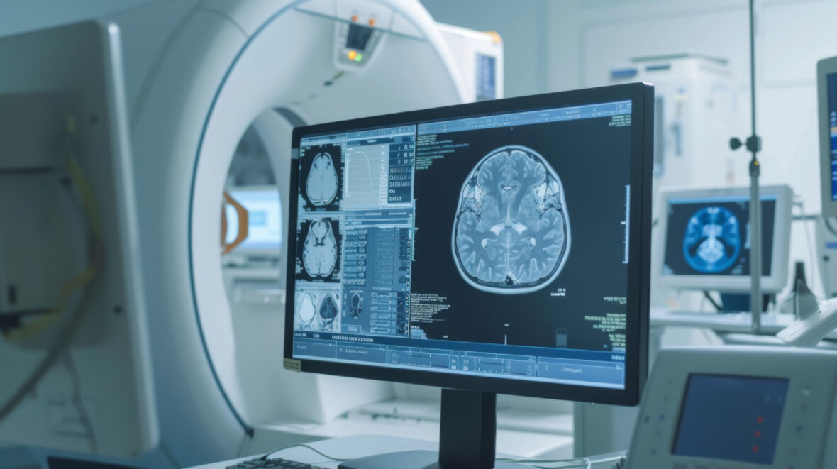 Medizinischer Monitor zeigt MRT-Aufnahme eines menschlichen Gehirns in einem Diagnostikraum.